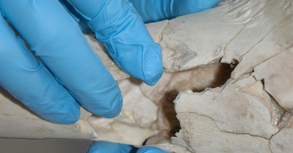  Introduction to Forensic Anthropology 